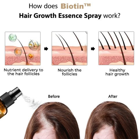 Spray essence pour la croissance des cheveux Biotin™ 