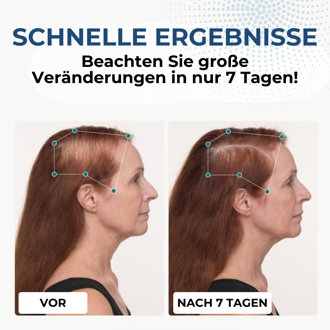 Eudora's Eden HairGenix™ Haarwuchs Kapseln