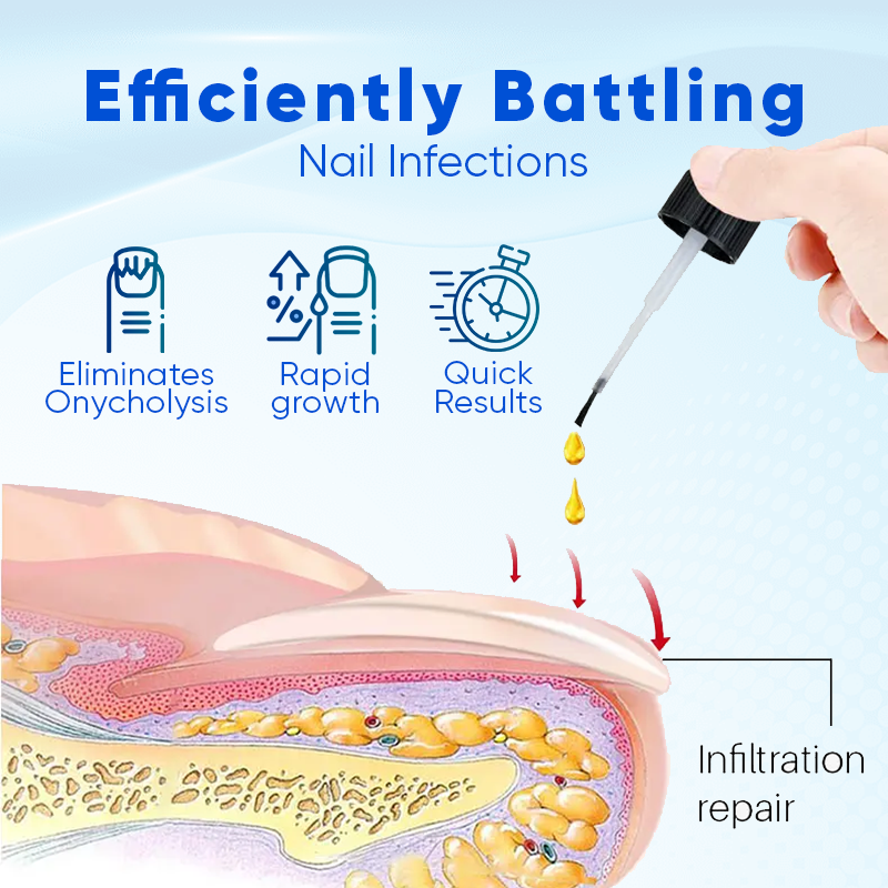 Sérum de croissance et de réparation des ongles Biancat™ OnyxoGuard 