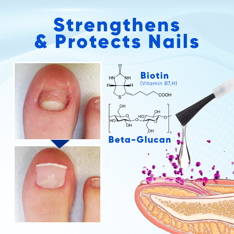 Eudora's Eden Biancat™ OnyxoGuard Nail Growth and Repair Serum