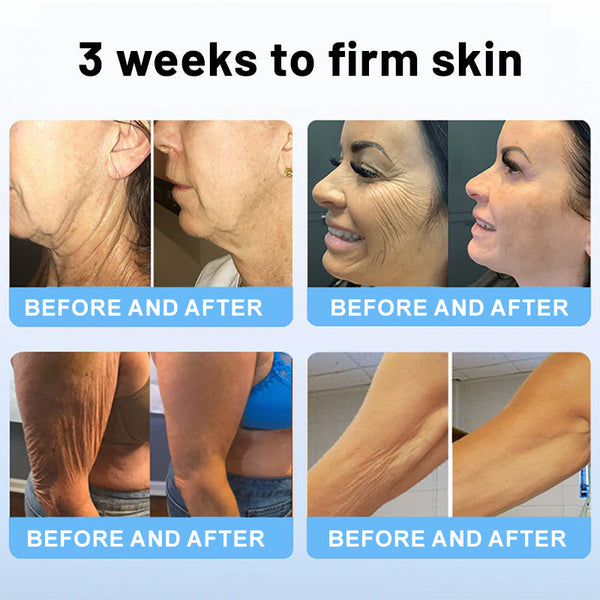 Fivfivgo Skin Rejuvenation Stick